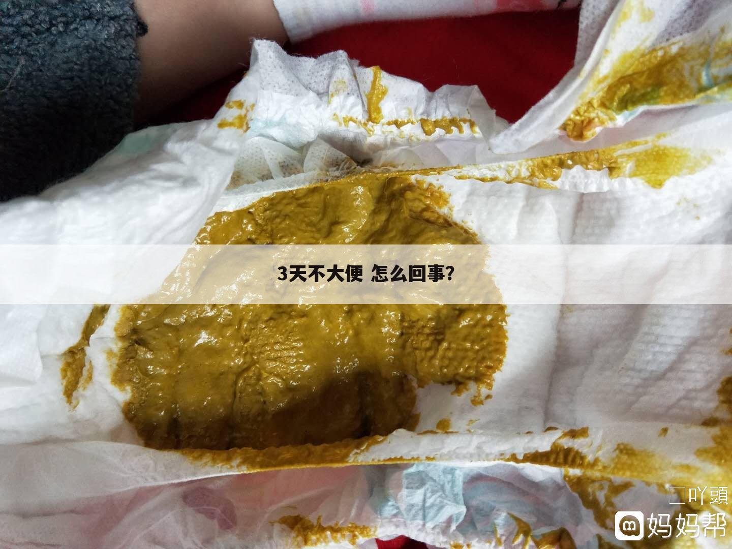 3天不大便 怎么回事？