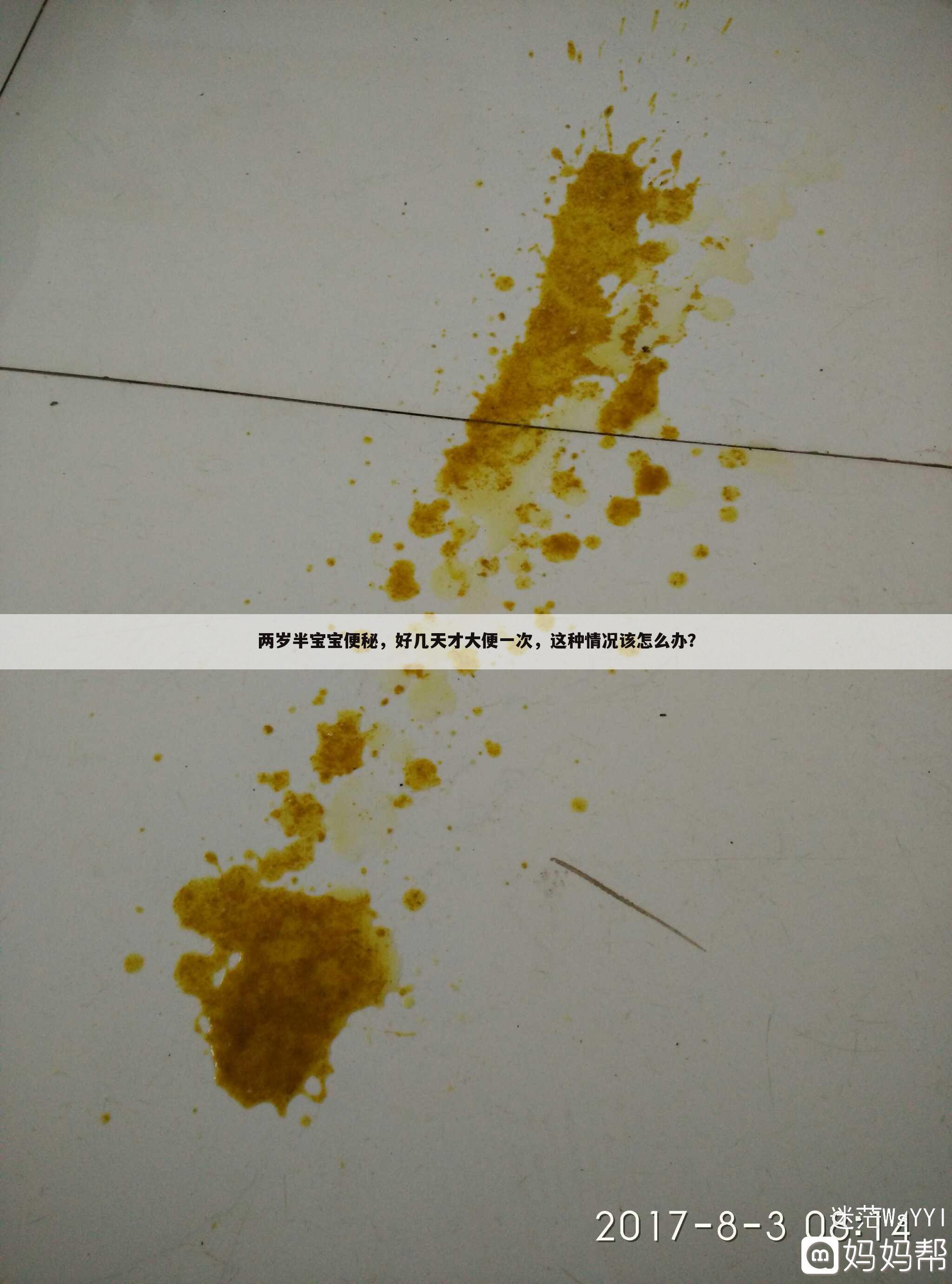 两岁半宝宝便秘,好几天才大便一次,这种情况该怎么办?