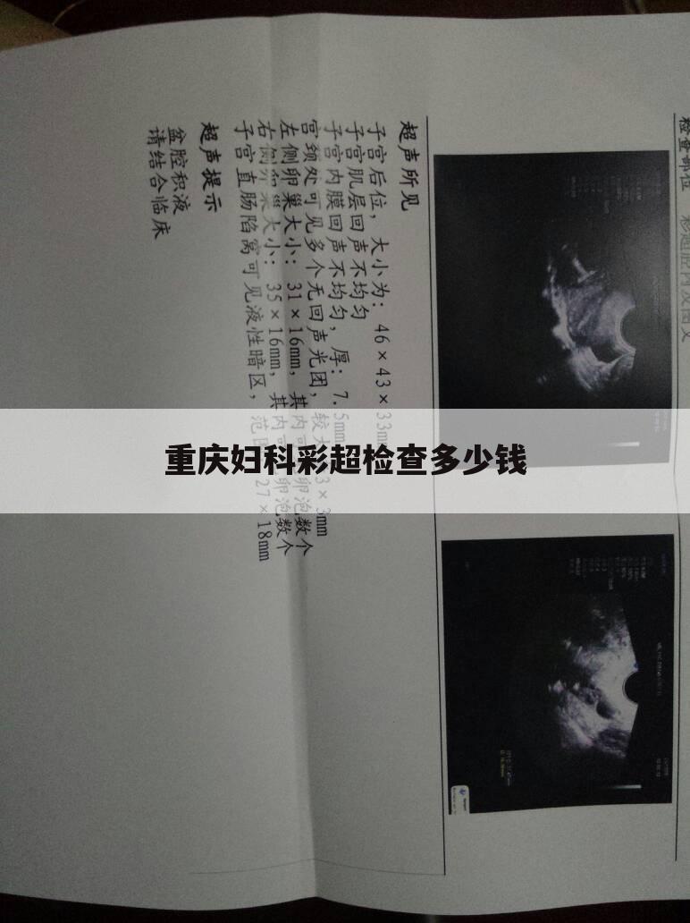 重庆妇科彩超检查多少钱