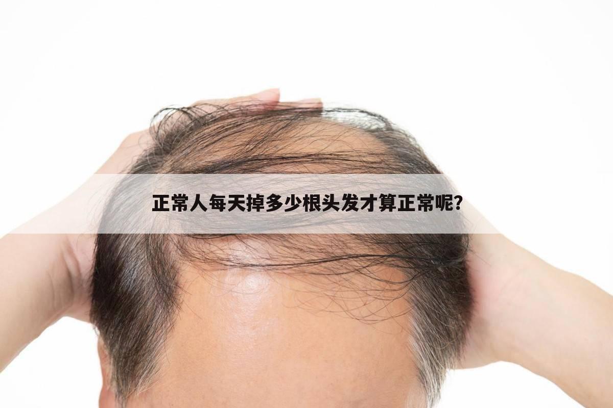 正常人每天掉多少根头发才算正常呢?