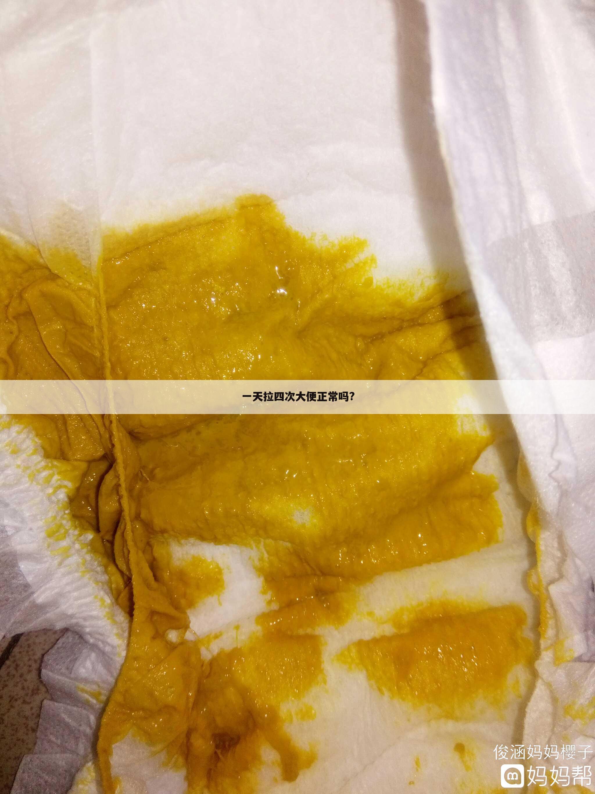 一天拉四次大便正常吗?