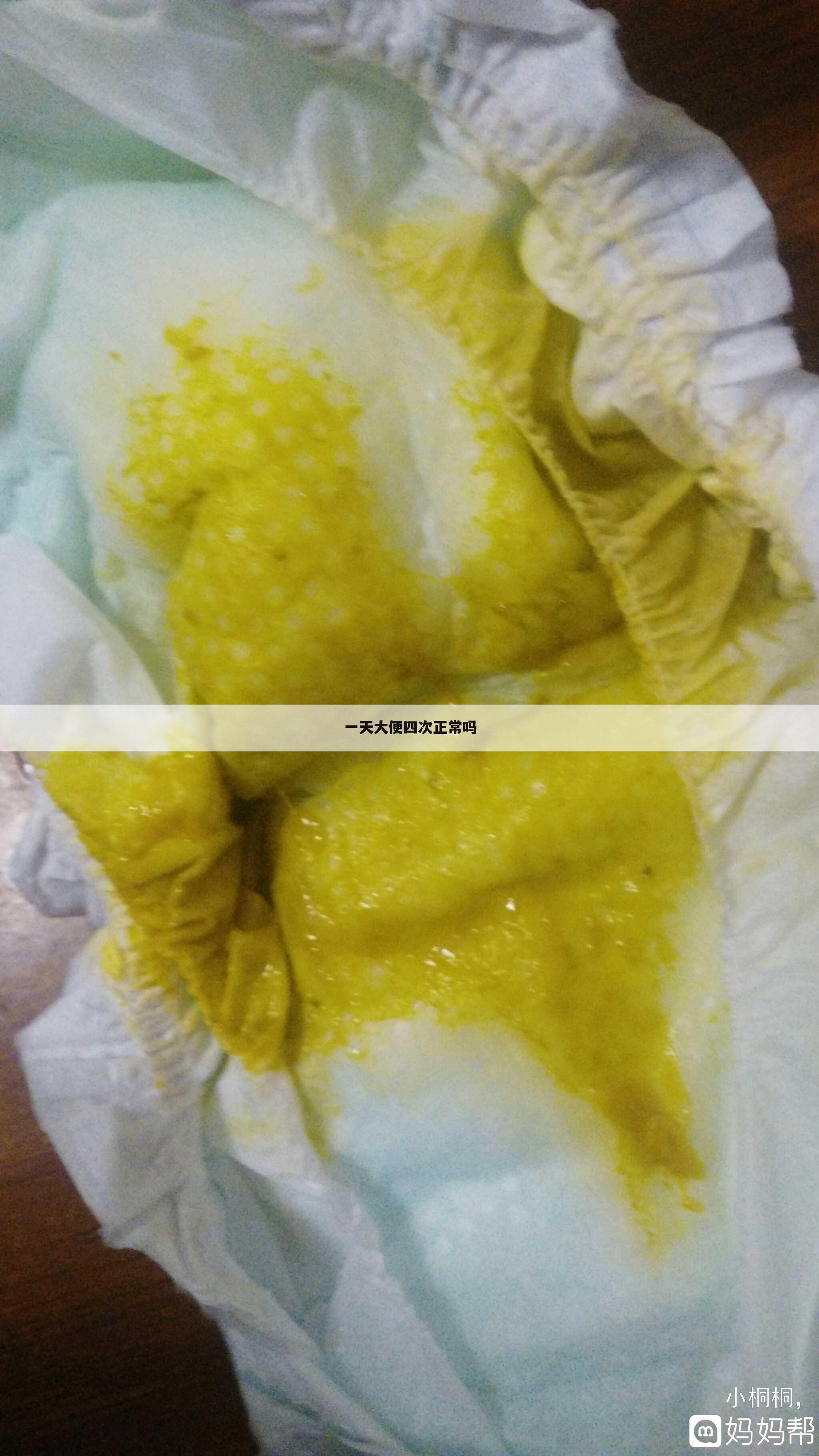 一天大便四次正常吗
