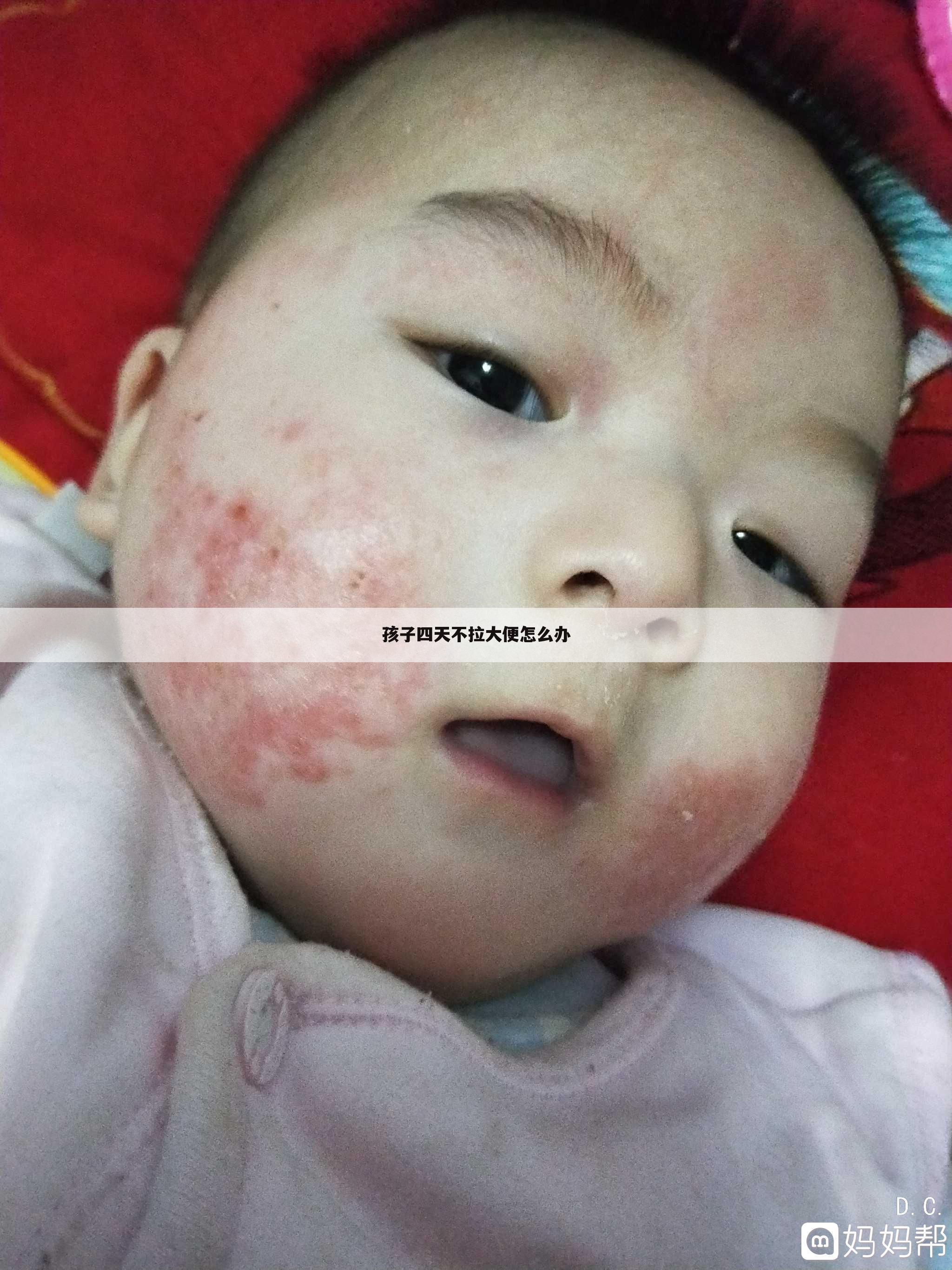 孩子四天不拉大便怎么办