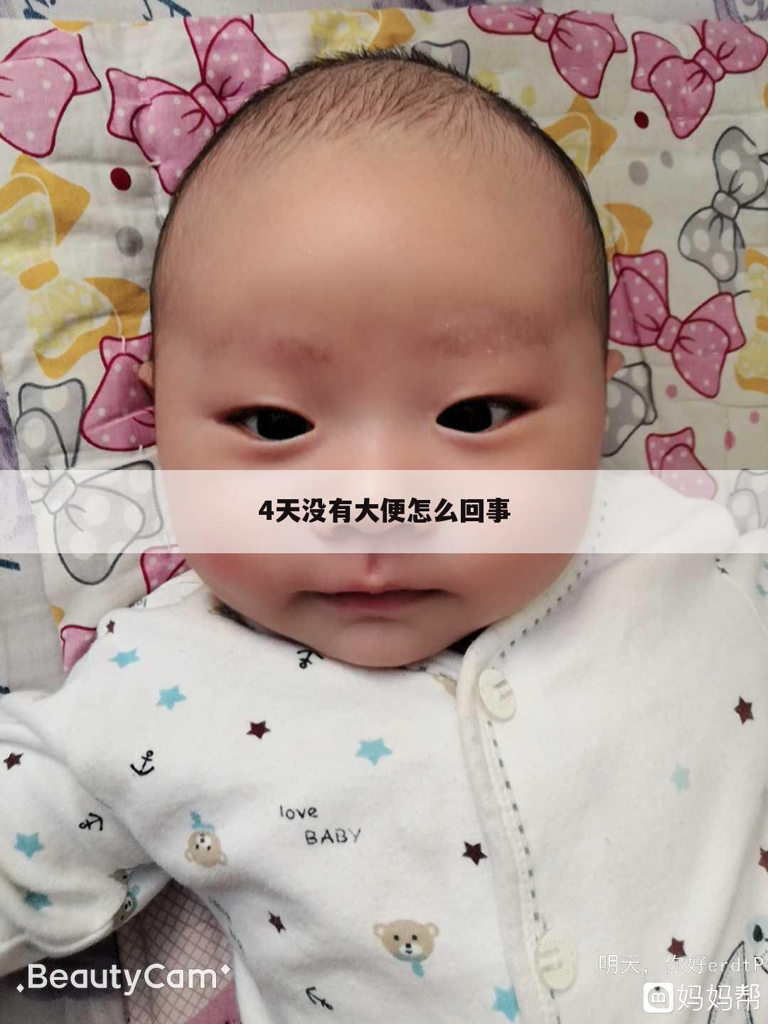 4天没有大便怎么回事