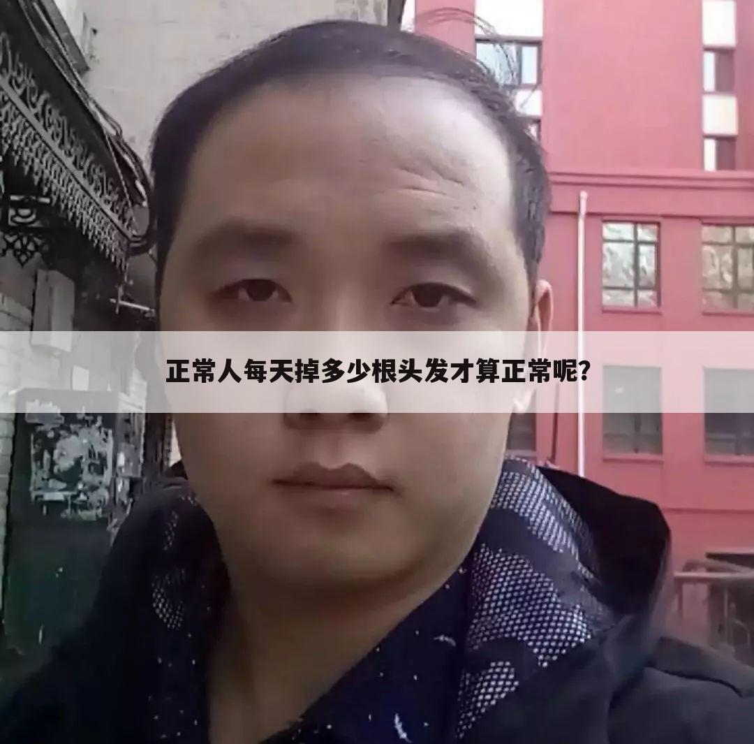 正常人每天掉多少根头发才算正常呢？