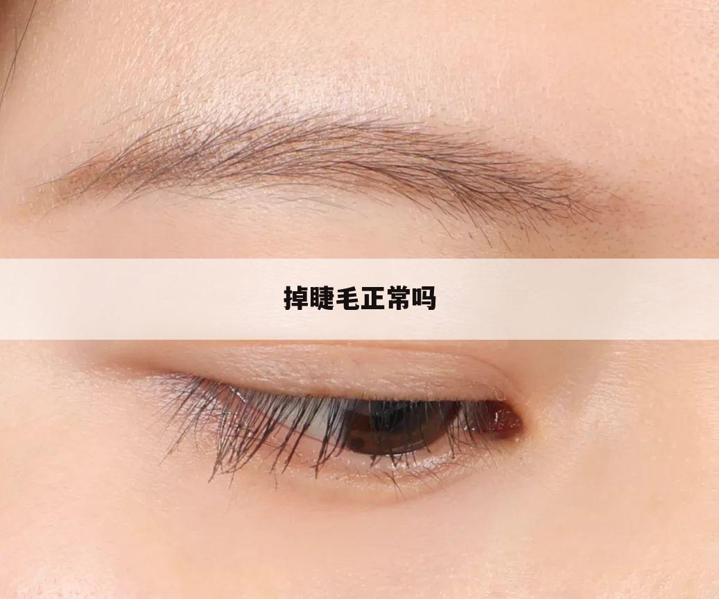 掉睫毛正常吗