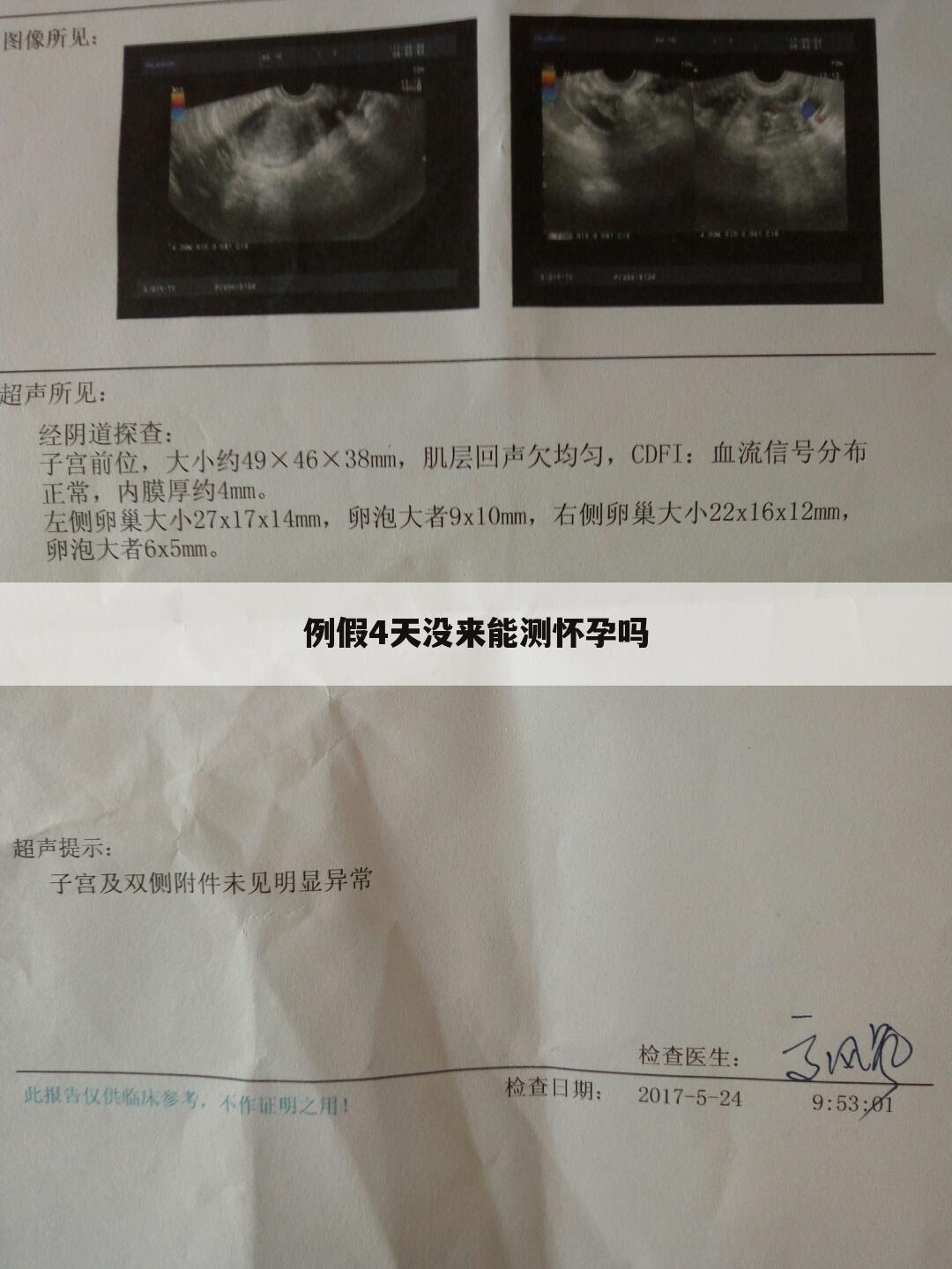 例假4天没来能测怀孕吗