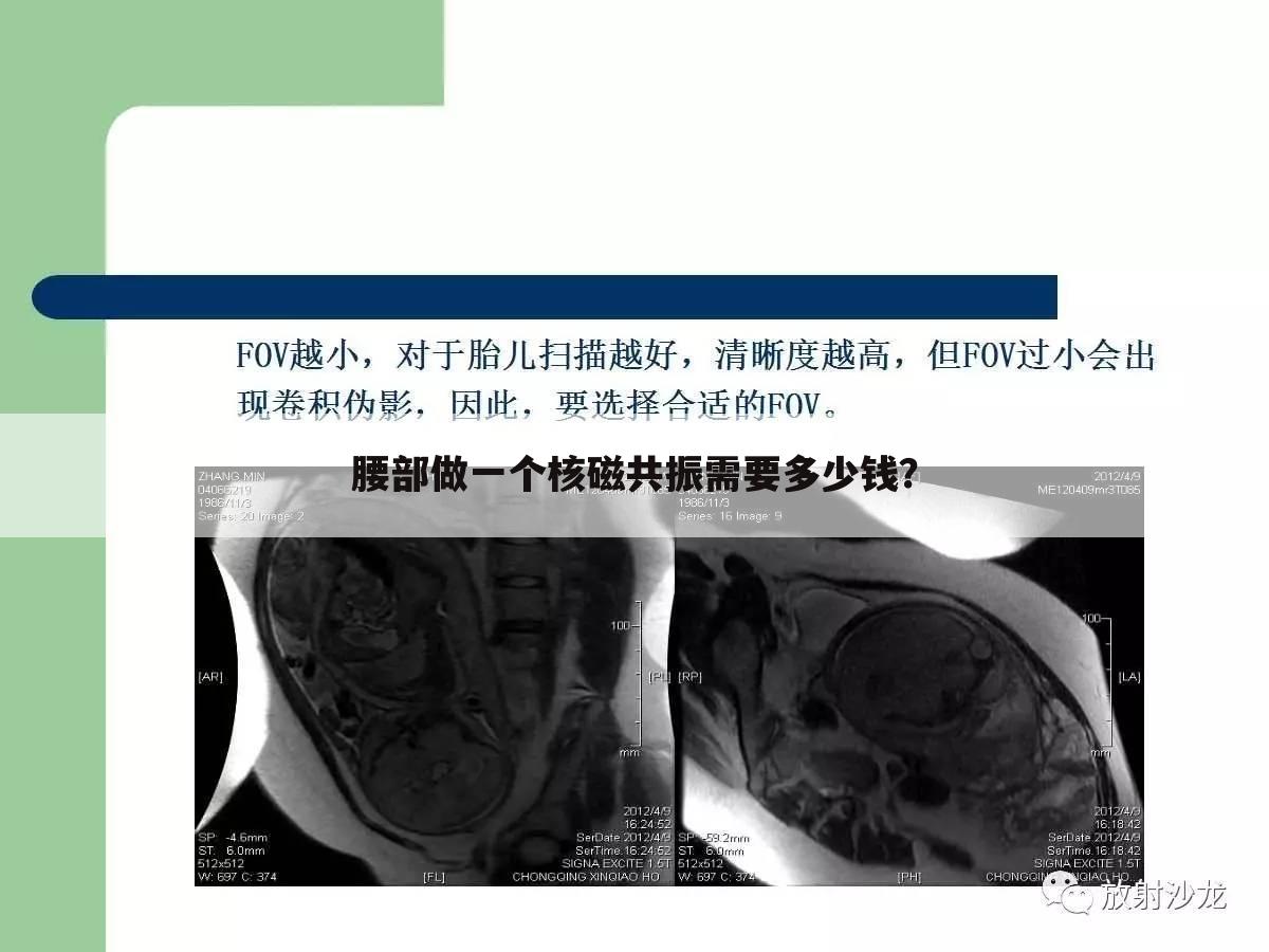 腰部做一个核磁共振需要多少钱?