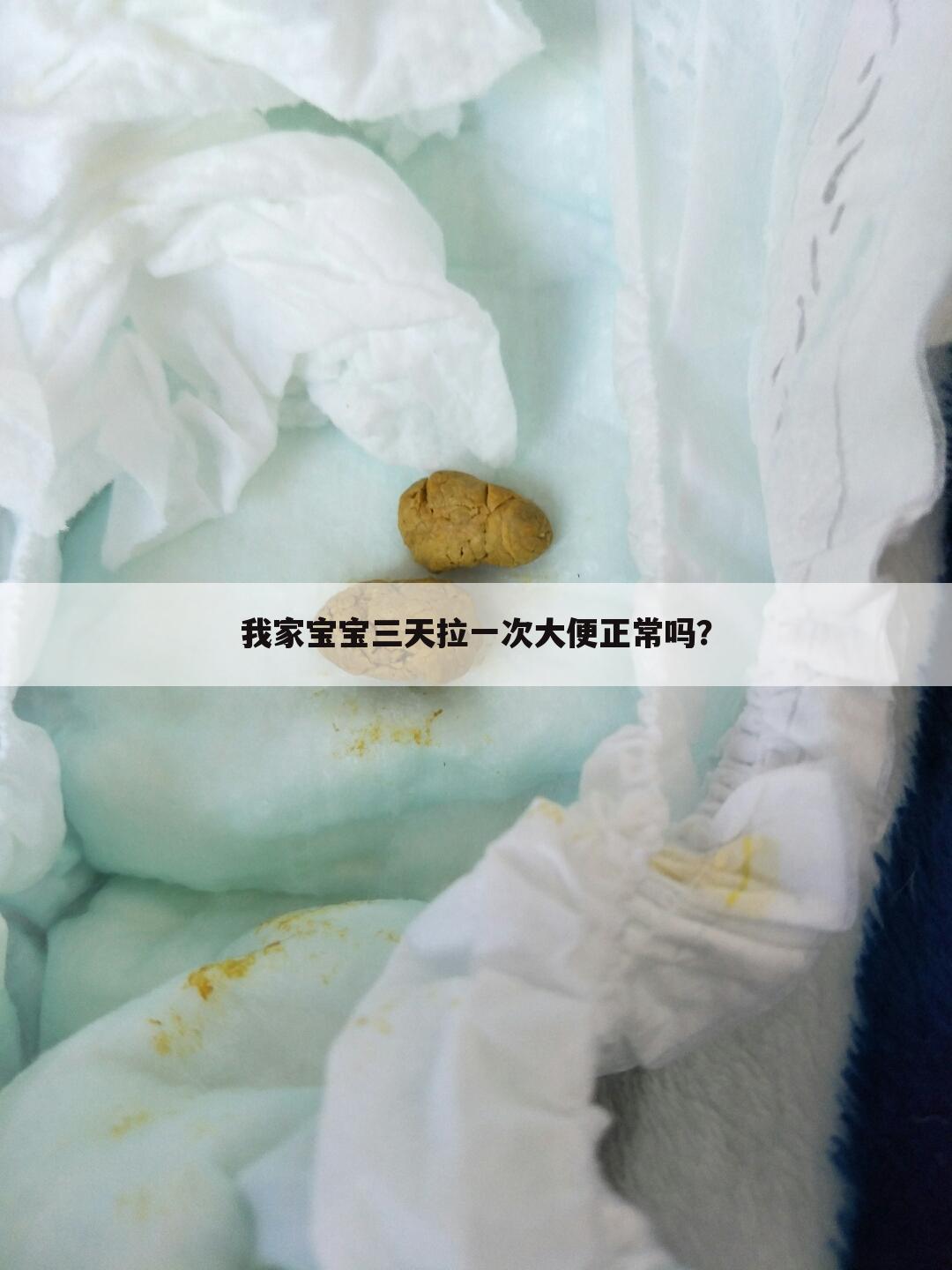我家宝宝三天拉一次大便正常吗？