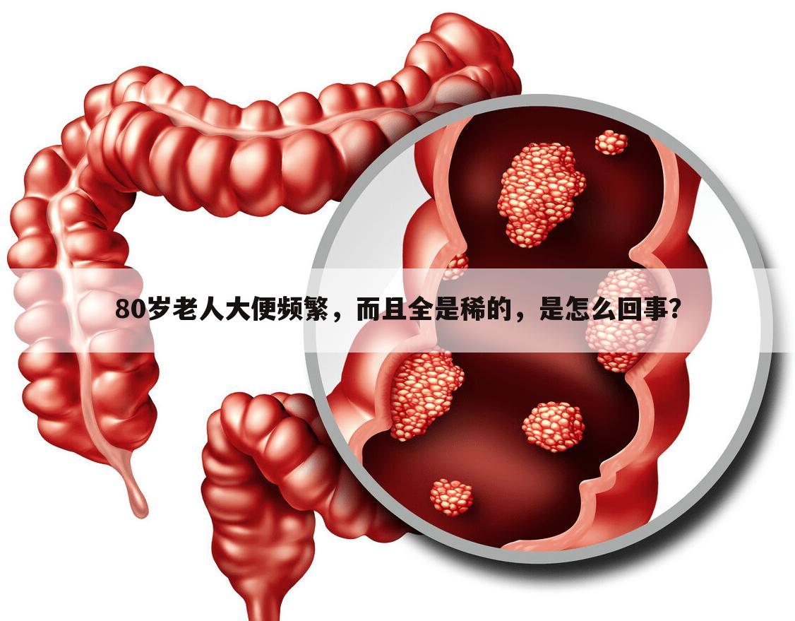 80岁老人大便频繁，而且全是稀的，是怎么回事？