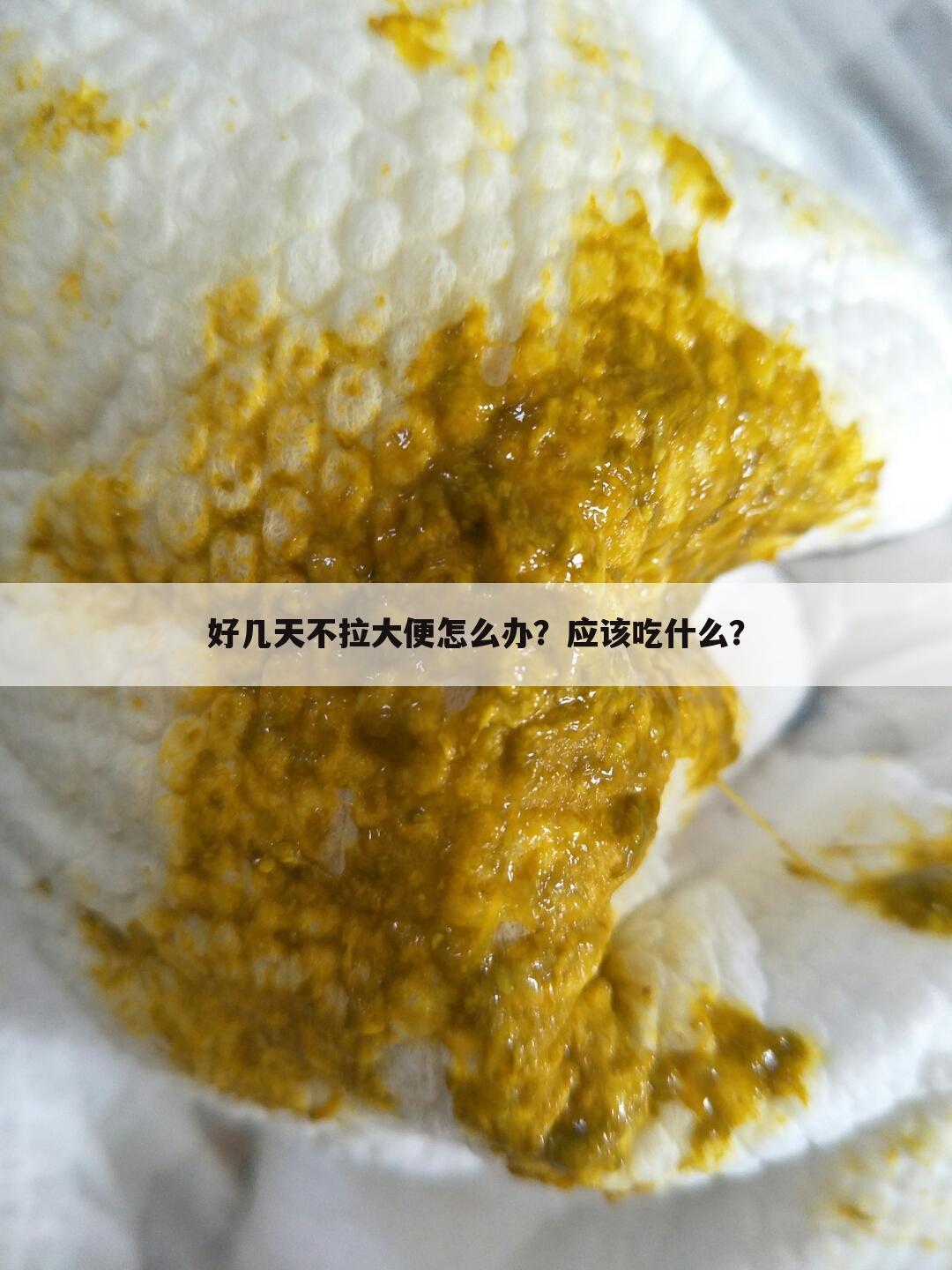 好几天不拉大便怎么办？应该吃什么？