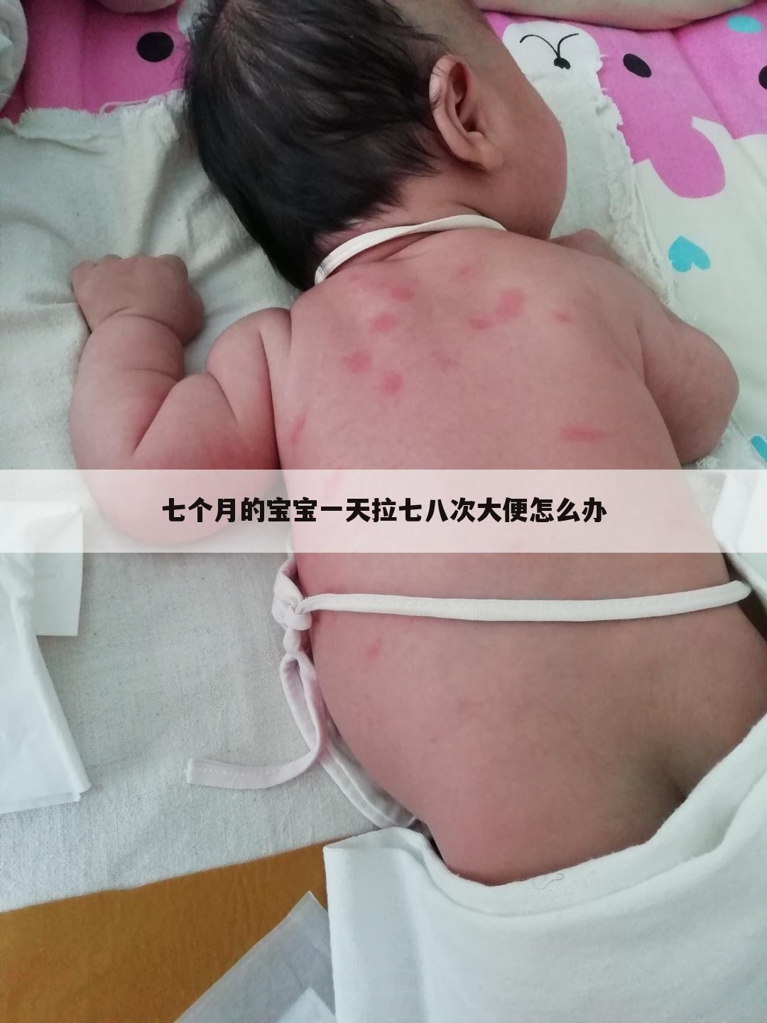 七个月的宝宝一天拉七八次大便怎么办
