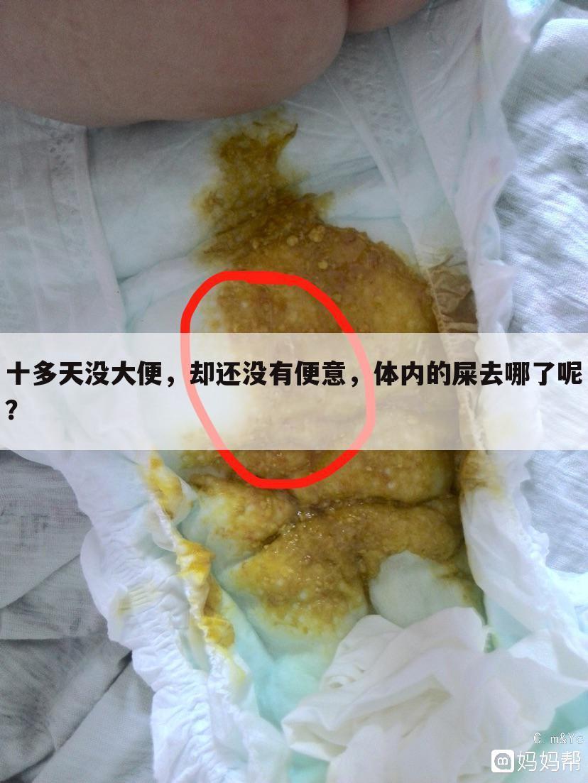 十多天没大便,却还没有便意,体内的屎去哪了呢?