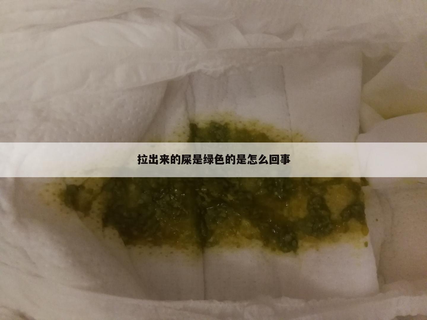 拉出来的屎是绿色的是怎么回事