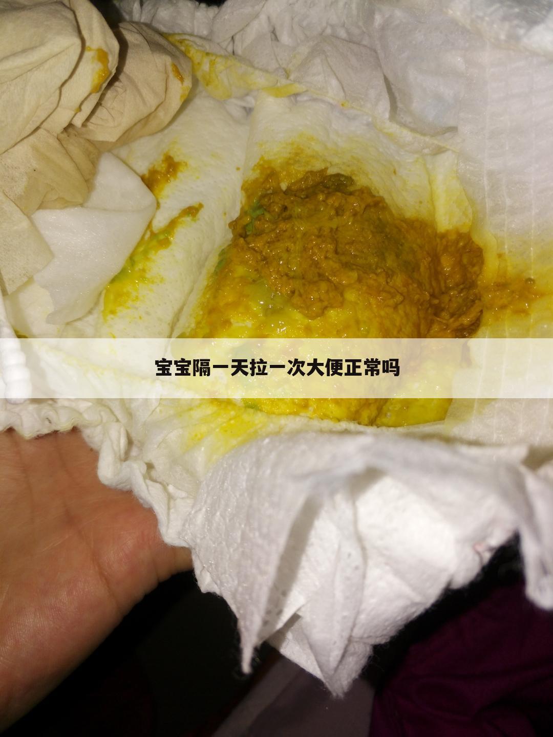宝宝隔一天拉一次大便正常吗