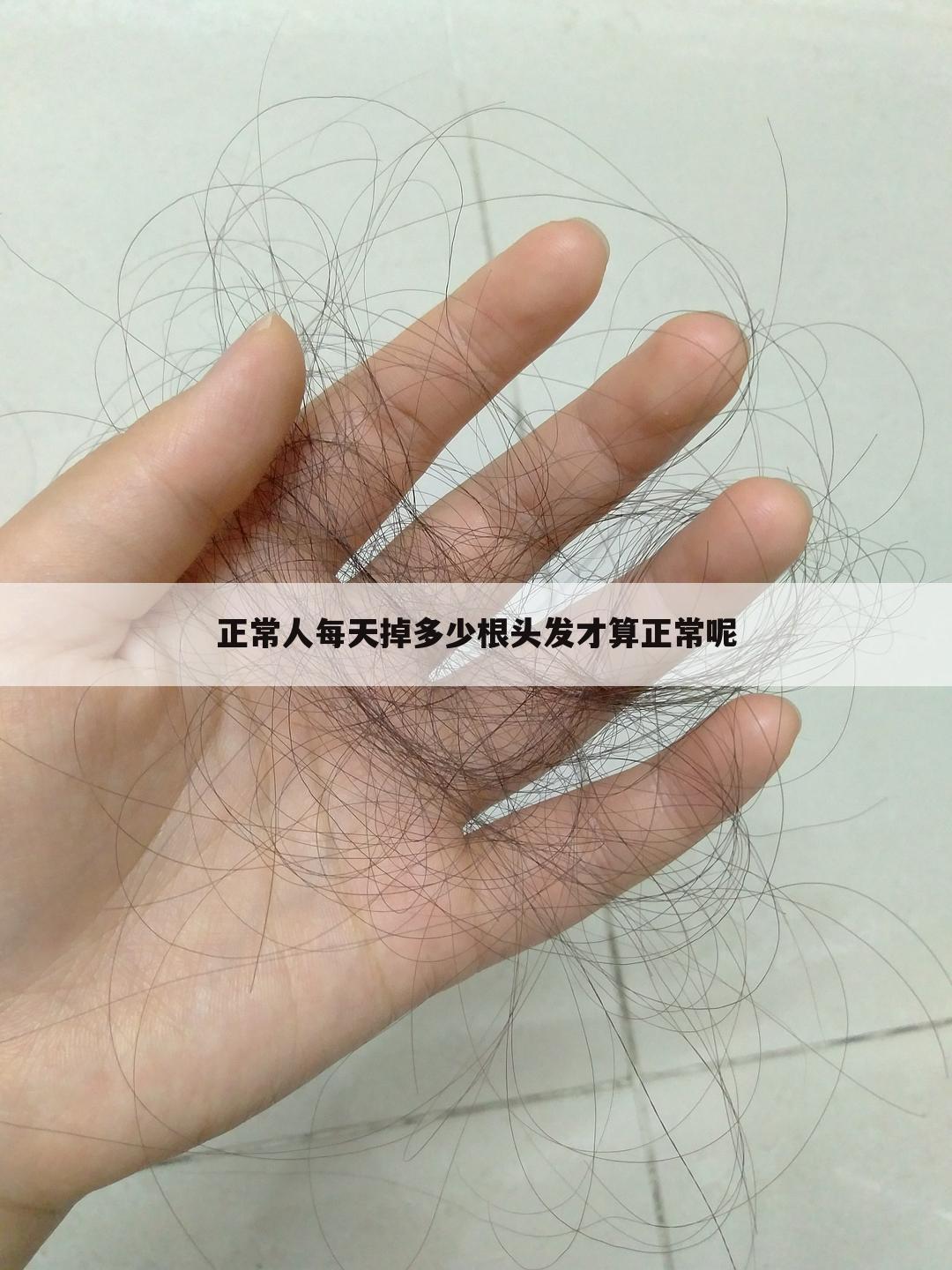 正常人每天掉多少根头发才算正常呢