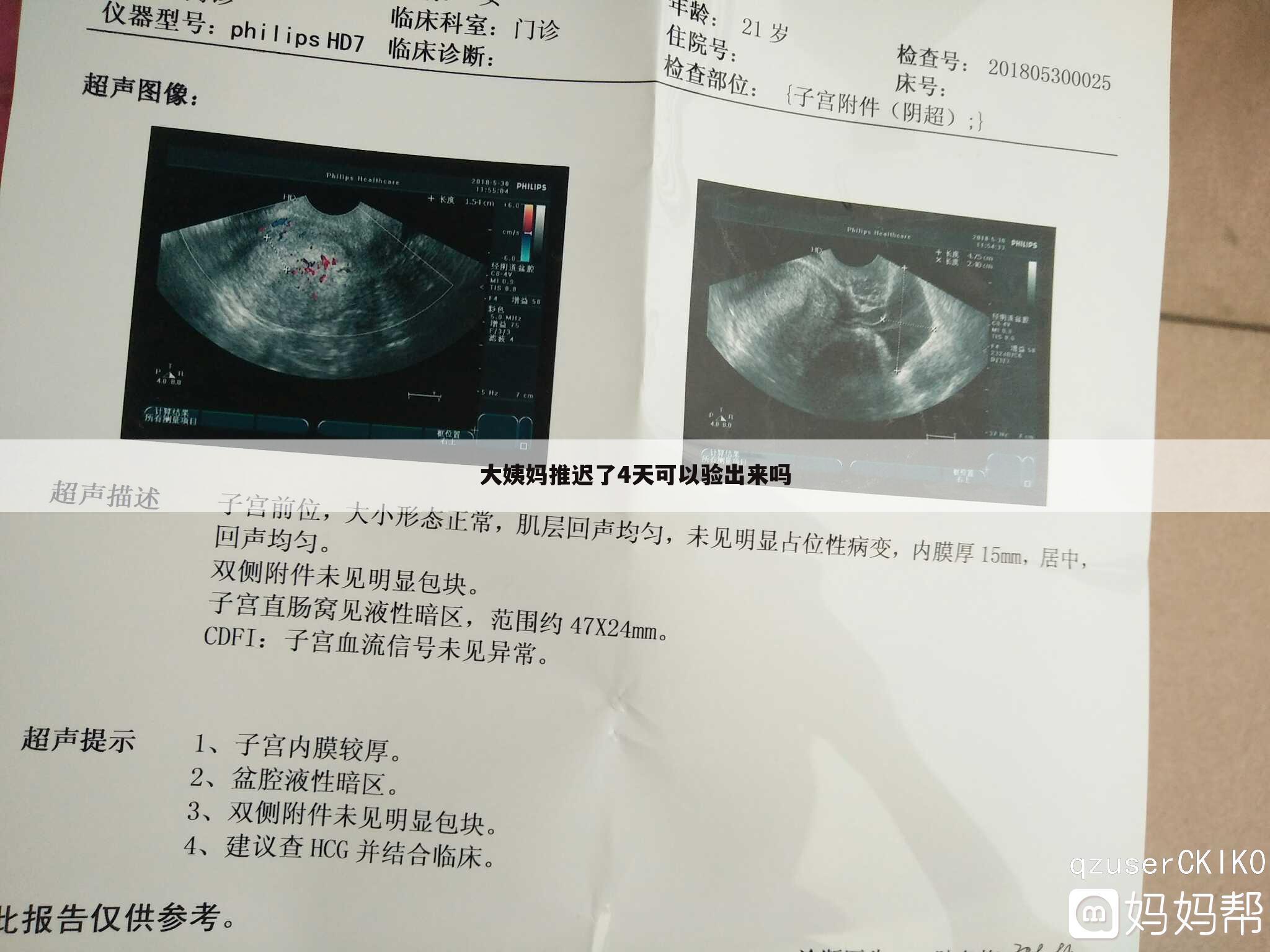 大姨妈推迟了4天可以验出来吗