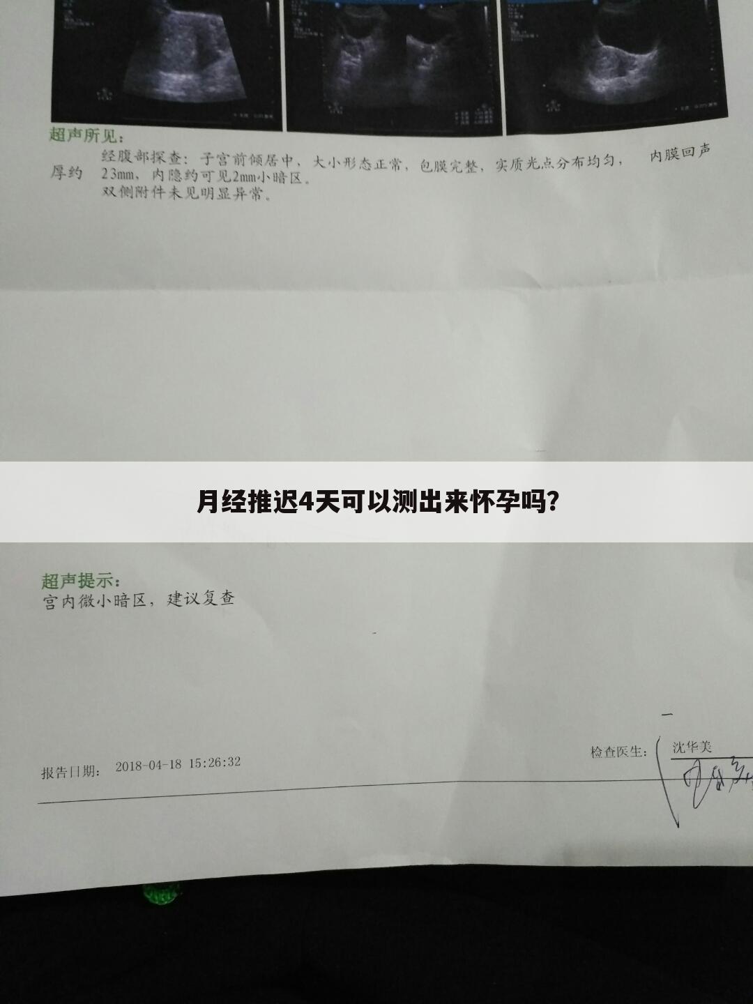 月经推迟4天可以测出来怀孕吗?