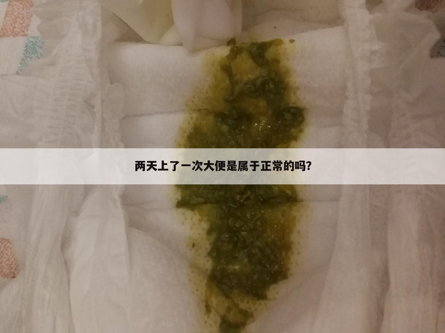 两天上了一次大便是属于正常的吗?