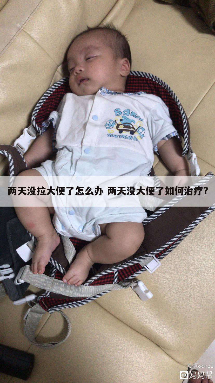 两天没拉大便了怎么办 两天没大便了如何治疗?