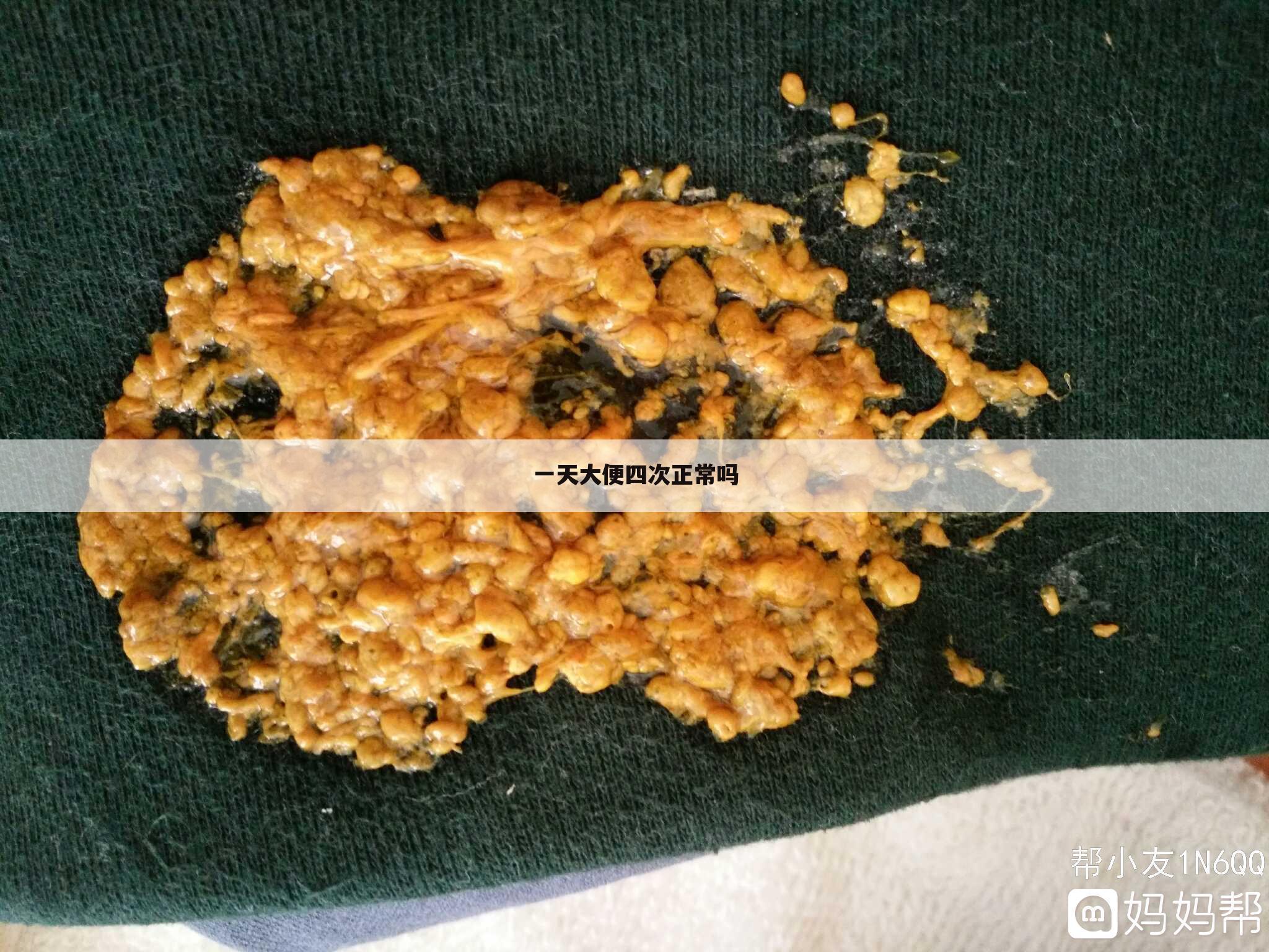 一天大便四次正常吗