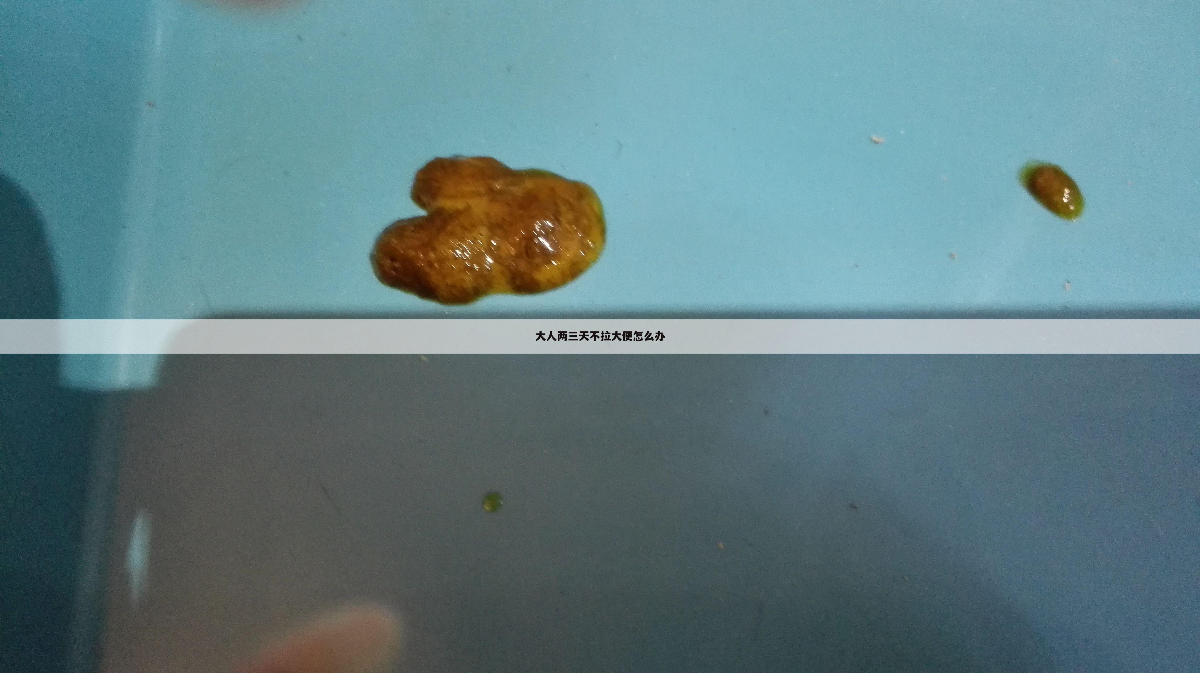 大人两三天不拉大便怎么办