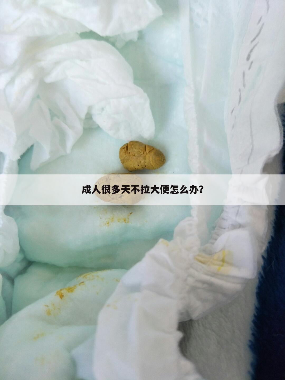 成人很多天不拉大便怎么办?