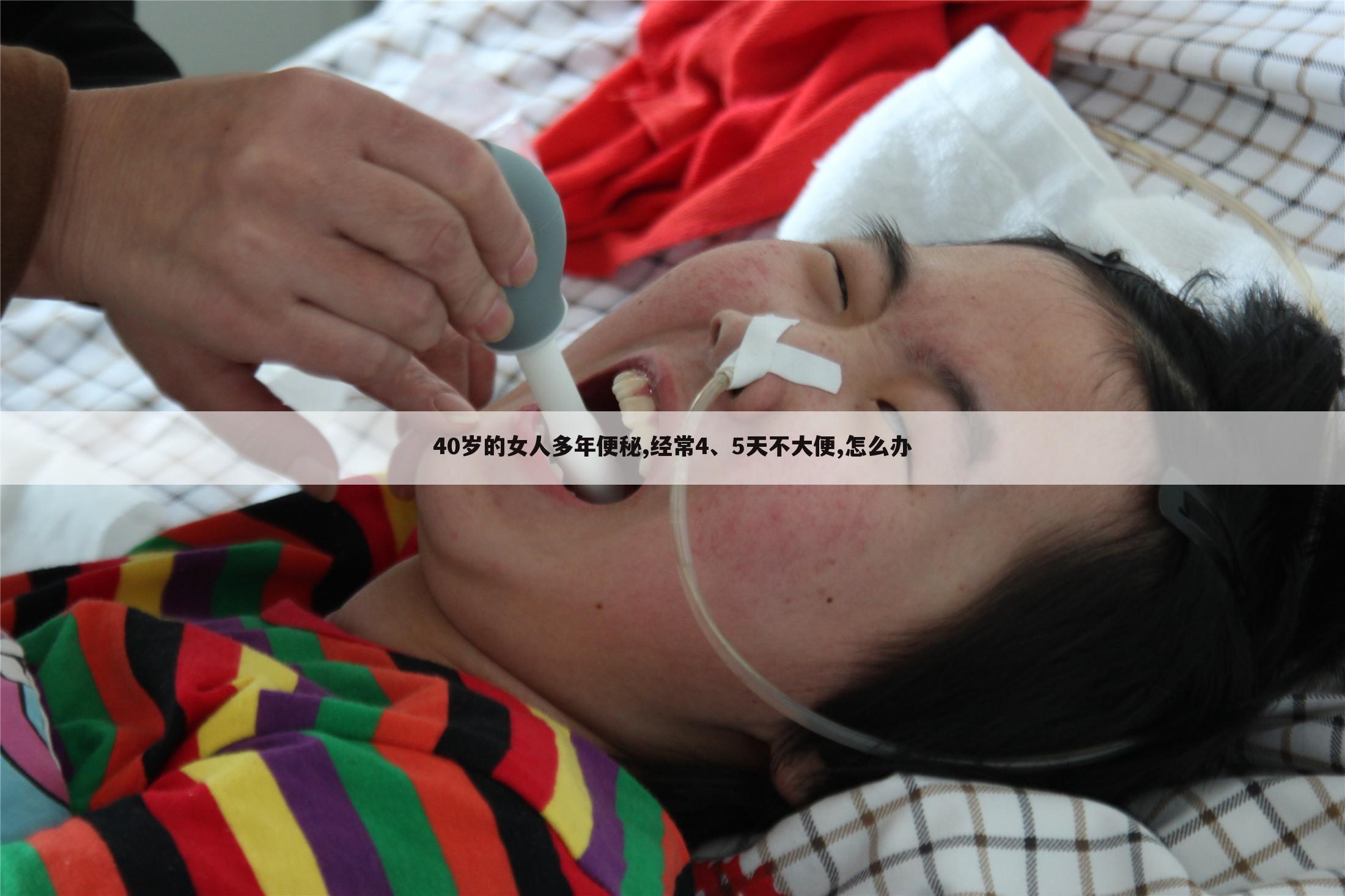 40岁的女人多年便秘,经常4、5天不大便,怎么办