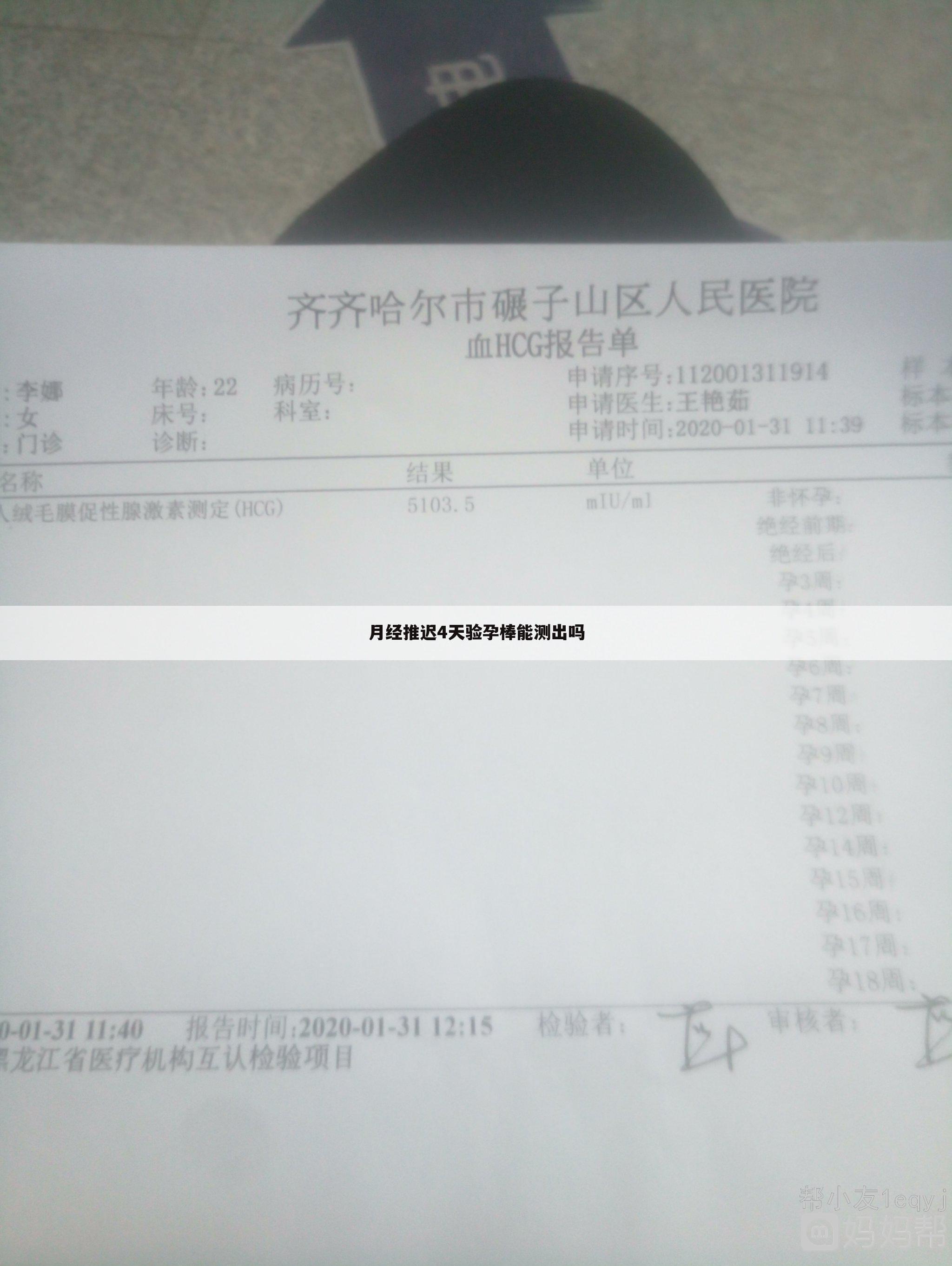 月经推迟4天验孕棒能测出吗