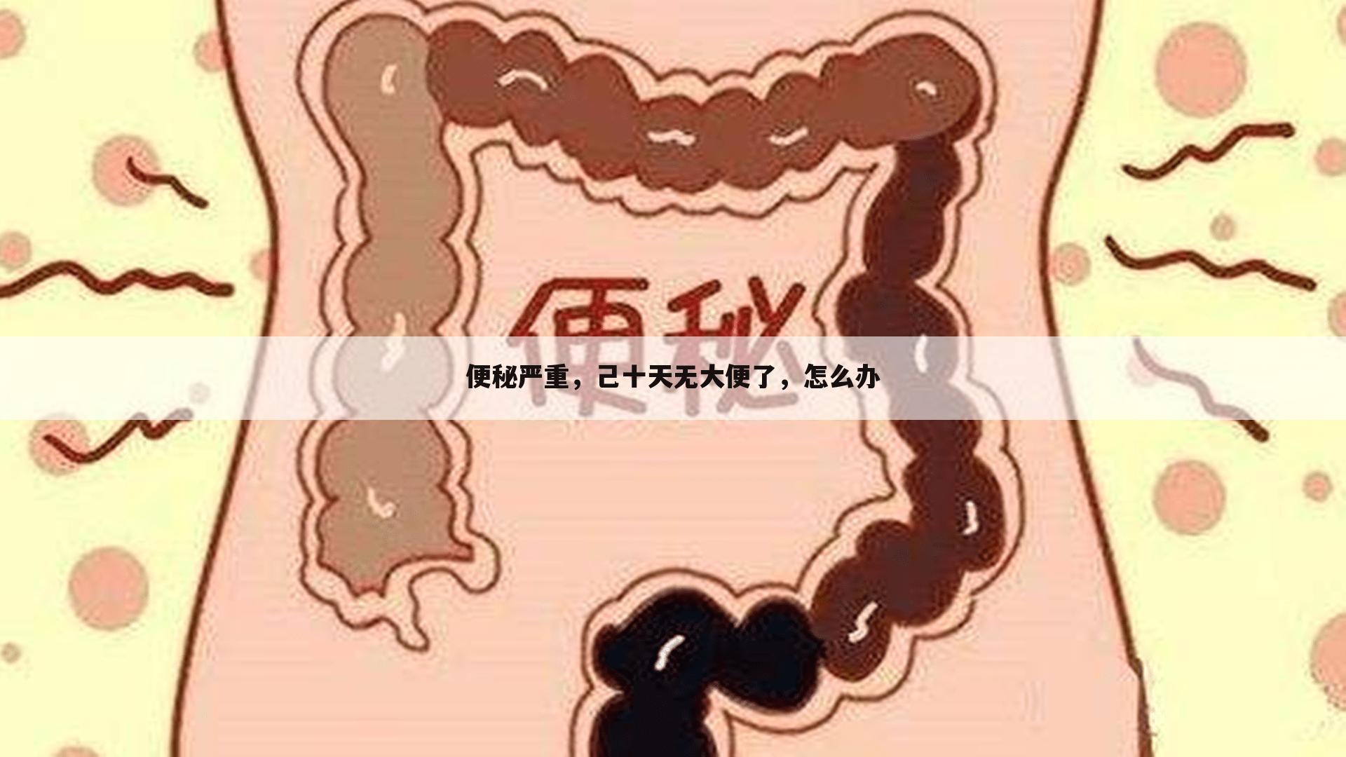 便秘严重,己十天无大便了,怎么办