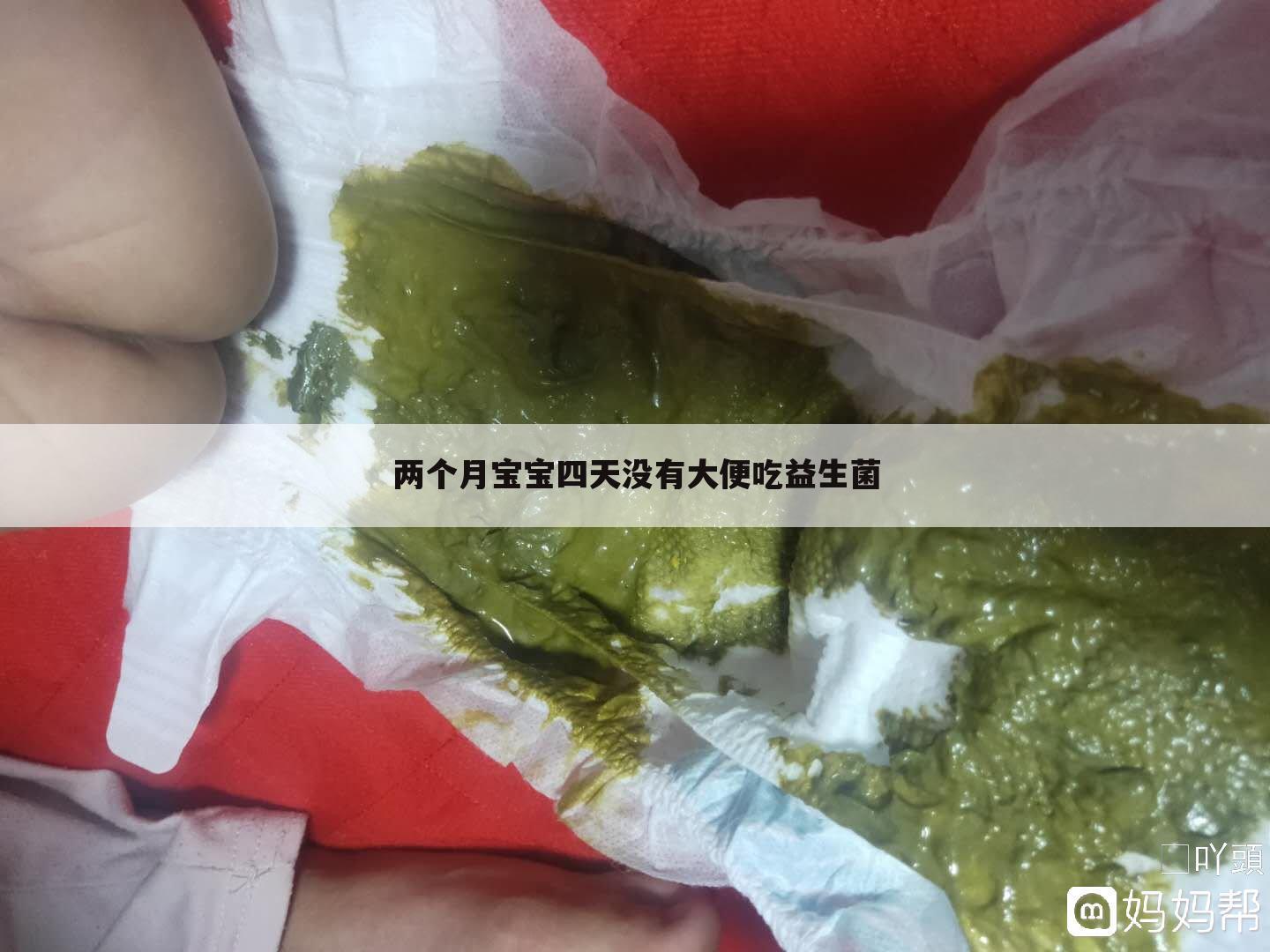 两个月宝宝四天没有大便吃益生菌