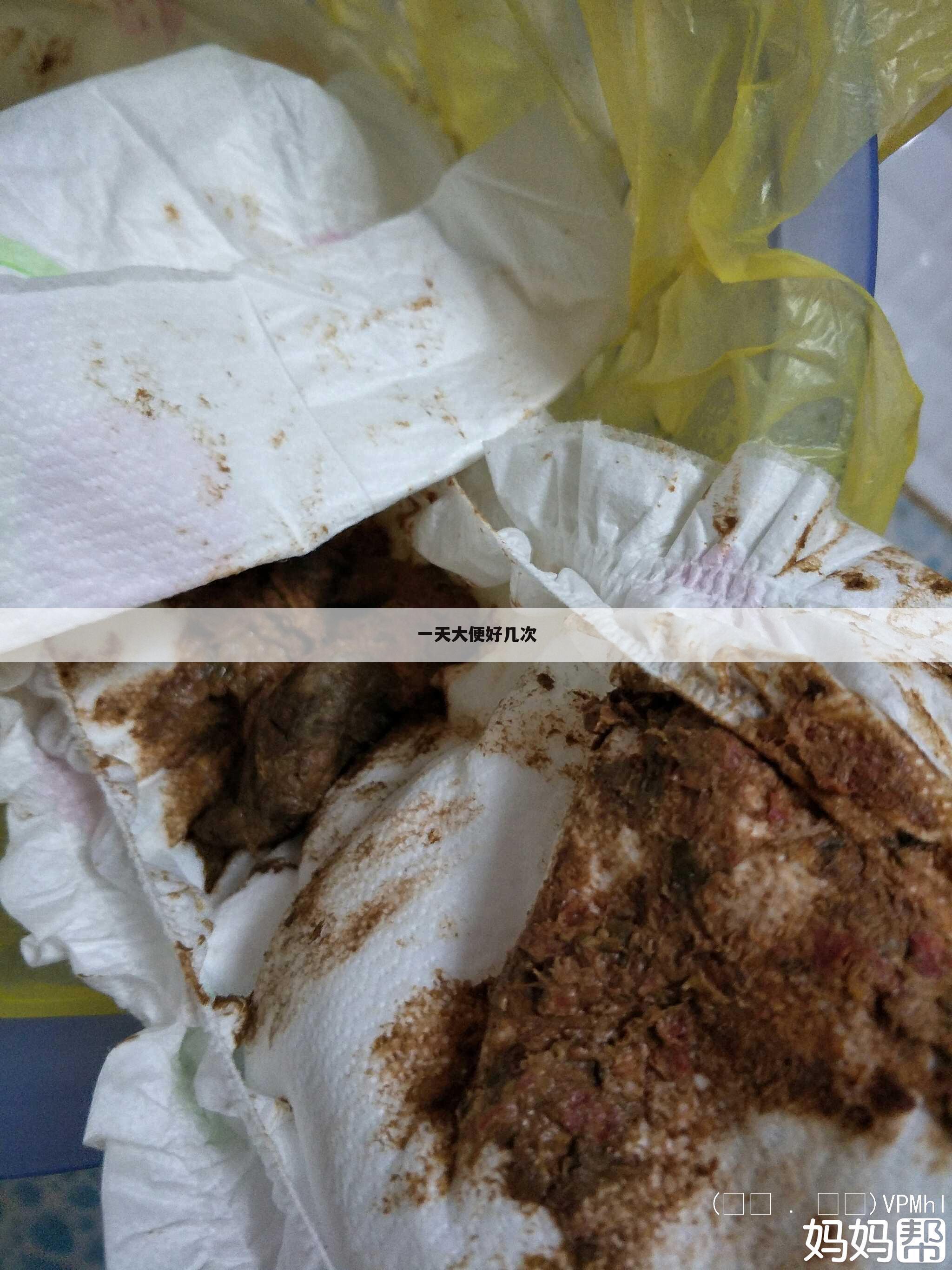 一天大便好几次